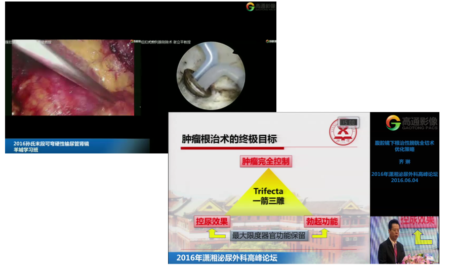 数字化手术室-视频资源管理平台图